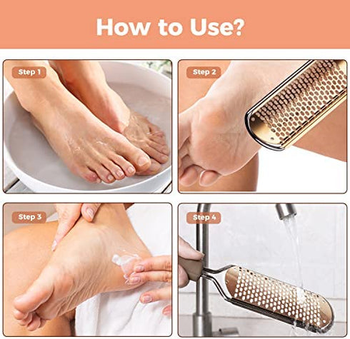 Foot File Foot Scrubber Pedicure - Callus Remover for Feet Easkep Professional Foot Grater Rasp Foot Scraper Corns Callous Removers Dry Skin Cracked Dead Skin Remover for Dry and Wet Feet (Golden)