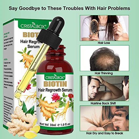 5 PACK Ginger Oil for Hair Growth,Hair Growth Serum,Biotin Hair Growth Oil,Hair Growth Ginger Serum for Men and Women,Hair Growth Treatment,Hair Loss Treatment,Promotes Thicker,Growth Hair