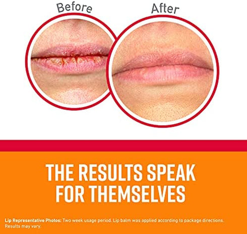 O'Keeffe's Medicated Lip Repair Seal & Heal Lip Protectant, Stick, (Pack of 2)