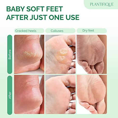 Foot Peel Mask with Strawberry 2 Pack Peeling Foot Mask Dermatologically Tested - Repairs Heels, Removes Dead Skin for Soft Baby Feet - Exfoliating Mask for Dry Cracked Feet