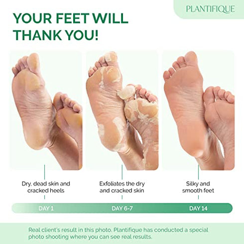 Foot Peel Mask with Strawberry 2 Pack Peeling Foot Mask Dermatologically Tested - Repairs Heels, Removes Dead Skin for Soft Baby Feet - Exfoliating Mask for Dry Cracked Feet