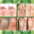 PurOrganica Urea 40% Foot Cream - No Pumice Stone - Callus Remover - Moisturizes & Rehydrates Thick, Cracked, Rough, Dead & Dry Skin - For Feet, Elbows and Hands - Made in USA