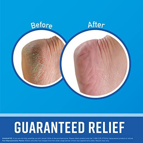 O'Keeffe's Working Hands Hand Cream, 3 Ounce Tube and Healthy Feet Foot Cream, 3 Ounce Tube