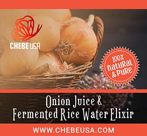 Onion Juice & Fermented Rice Water Elixir (Keep Your Scalp Healthy-Healthy Scalp=Healthy Hair Growth) 2oz