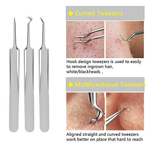 Blackhead Remover Tool, Aooeou Professional Pimple Popper Tool Kit - Treatment for Blemish, Whitehead Popping, Zit Removing for Risk Free Nose Face, Anti-Slip Coating Handle (b-Silver)
