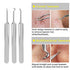 Blackhead Remover Tool, Aooeou Professional Pimple Popper Tool Kit - Treatment for Blemish, Whitehead Popping, Zit Removing for Risk Free Nose Face, Anti-Slip Coating Handle (b-Silver)