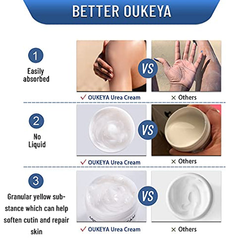 OUKEYA Urea Cream 40 Percent, Urea Foot Cream for Dry Cracked, 40 per Urea Lotion for Feet Maximum Strength