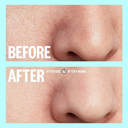 Peace Out Skincare Pores. Hydrocolloid Pore-Refining Nose and Face Strips with Vitamin A to Shrink Enlarged Pores and Remove Excess Oil (4 pore and 4 nose strips)