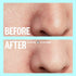 Peace Out Skincare Pores. Hydrocolloid Pore-Refining Nose and Face Strips with Vitamin A to Shrink Enlarged Pores and Remove Excess Oil (4 pore and 4 nose strips)