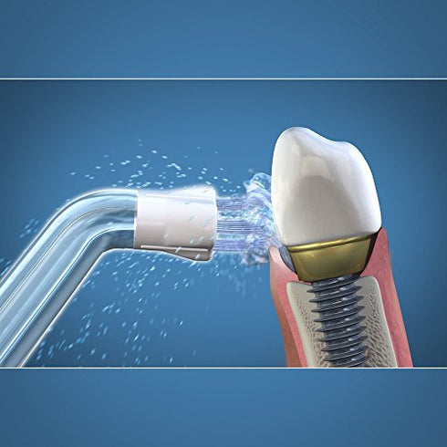 Waterpik Genuine Plaque Seeker Replacement Tips, Water Flosser Tip Replacement, Basic, (Pack of 2), 1 Count