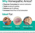VitaMedica | Arnica Montana | 30X | HPUS | Made in USA | Plant Based | Bruising | Swelling & Inflammation | Muscle Pain Relief | Post Surgery | Homeopathic Remedies | Arnica Tablets | 150 Ct