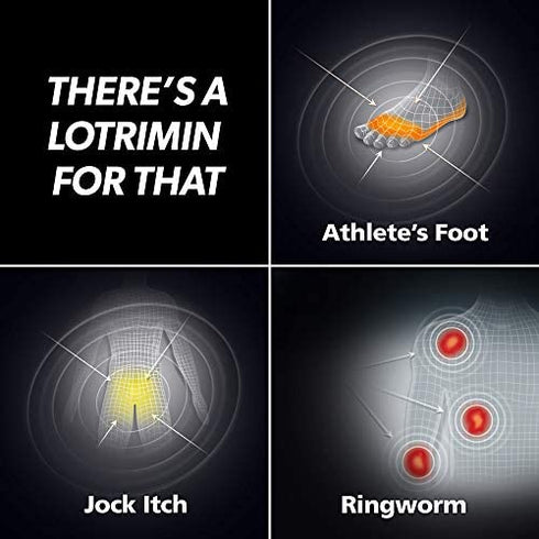 Lotrimin AF Athlete's Foot Antifungal Powder, Miconazole Nitrate 2% Treatment, Clinically Proven Effective Antifungal Treatment of Most AF, Jock Itch and Ringworm, 3 Oz (Pack of 3)