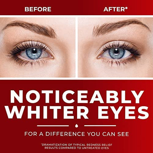 Clear Eyes Maximum Redness Eye Relief Eye Drops, 1 Fl Oz, 3 Pack