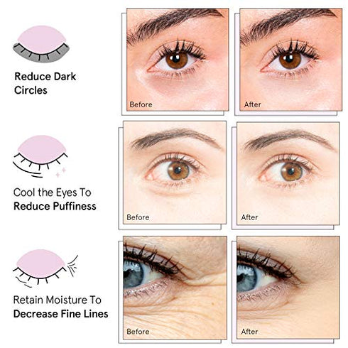 Under Eye Mask - (24 Pairs, Gold) Reduce Dark Circles, Puffy Eyes, Undereye Bags, Wrinkles - Gel Under Eye Patches, Vegan Cruelty-Free Self Care by grace and stella