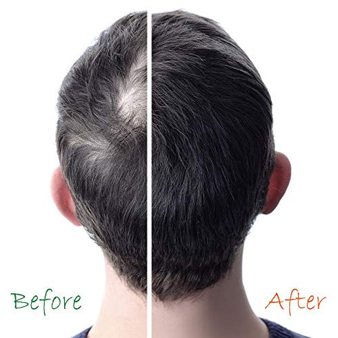 Original Hair Growth Booster - Pro Vitamin-B5, DHT-Blocker, Sulfate-Free & Paraben-Free - for Thinning & Receding Hair - Color Safe for Men, Women & Teens, 2 fl oz