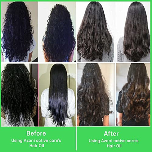 Azani Hair Growth Oil for Thicker, Stronger & Fuller Hair | Jojoba & Castor Oil with Redensyl | Prevents Hair Fall & Hair Thinning - Women & Men, 6.76 Oz | 100% Vegan and Cruelty Free