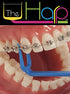 The Harp Orthodontic Reusable Flosser