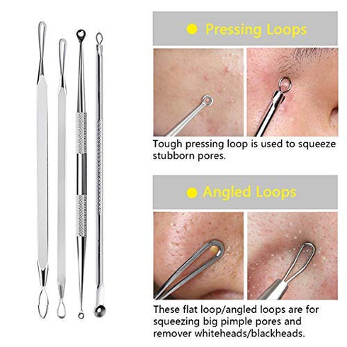 Blackhead Remover Tool, Aooeou Professional Pimple Popper Tool Kit - Treatment for Blemish, Whitehead Popping, Zit Removing for Risk Free Nose Face, Anti-Slip Coating Handle (b-Silver)