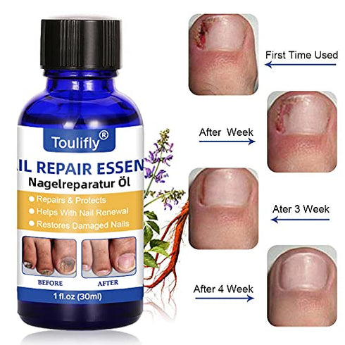 Nail Repair, Fingernail and Toenail Repair, Maximum Strength Nail Solution, Repairs and Protects Toenail and Fingernail from Discoloration, Brittle and Crack