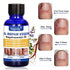 Nail Repair, Fingernail and Toenail Repair, Maximum Strength Nail Solution, Repairs and Protects Toenail and Fingernail from Discoloration, Brittle and Crack