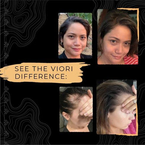 Viori Shampoo Bar, Hidden Waterfall - Handcrafted with Longsheng Rice Water & Natural Ingredients - Sulfate-free, Paraben-free, Cruelty-free, Phthalate-free, pH balanced 100% Vegan, Zero-Waste