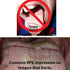 RPE Tongue Guard: Prevents and Helps Heal Tongue Sores Caused by Dental Expanders