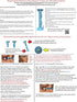 OptiWand Soft Contact Lens Insertion and Removal Tool. It Will Help Pinch The Soft Lens. This is not a Suction Cup for Soft Lens Removal