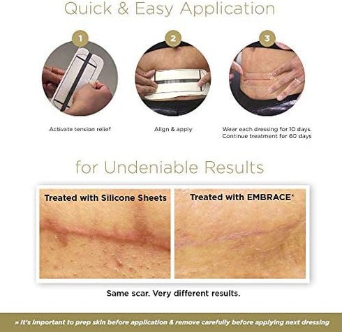 Embrace Active Scar Defense for New Scars, FDA-Cleared Silicone Scar Sheets, 6.3 Inch, X-Large, 30 Day Supply