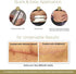 Embrace Active Scar Defense for New Scars, FDA-Cleared Silicone Scar Sheets, 6.3 Inch, X-Large, 30 Day Supply
