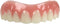 Instant Smile Comfort Fit Flex - Natural Shade - Upper Veneer Cosmetic Teeth