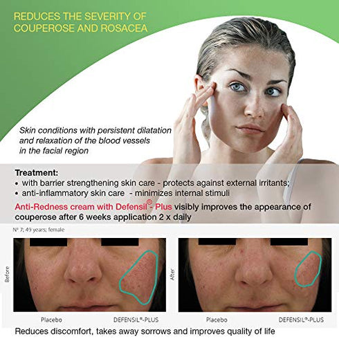 Redness Relief Face Eczema Cream - All-Natural Anti Itch Cream - Fast-acting Rosacea Treatment for Face - Facial Moisturizer and Eczema Treatment Body Cream - Hormone-Free Rosacea Skin Care Products