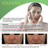 Redness Relief Face Eczema Cream - All-Natural Anti Itch Cream - Fast-acting Rosacea Treatment for Face - Facial Moisturizer and Eczema Treatment Body Cream - Hormone-Free Rosacea Skin Care Products