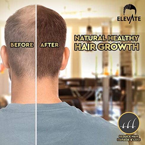 ELEVATE Hair Growth Oil - Biotin Hair Growth Serum & Castor Oil Natural Vitamin Rich Treatment for Stronger Thicker Longer Hair Regrowth & Thickening – Prevent Hair Loss & Thinning for Men & Women 1 Fl Oz 30mL