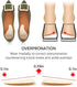 Dr. Shoesert Supination & Over-Pronation Inserts, Medial & Lateral Heel Insoles for Foot Alignment, Knee Pain, Bow Legs, Osteoarthritis - 2 Pairs (Medium - Women's 8-11.5|Men's 6-10.5)