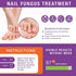 pureskin Fungal Nail Renewal - Maximum Strength Nail Fungus Treatment, Toe Fungus Nail Treatment, Health Care Solution for Finger & Toenail Fungus, Athlete's Foot, Ringworm by Fungus
