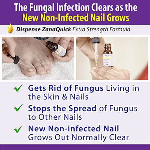 ZanaQuick Toenail Fungus Treatment Drops - 2 Pack - Nail Fungus Treatment For Toenail Remedy, Powerful Nail Fungus Treatment For Fingernail & Toenail