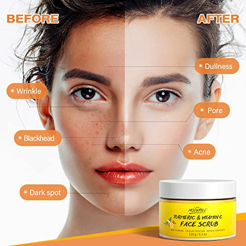Vitamin C and Turmeric Face Scrub Cream Organics Microdermabrasion Facial Scrub Brightening Exfoliating Clears Blackheads Improve Dark Spot Acne with Strawberry Extract Exfoliator