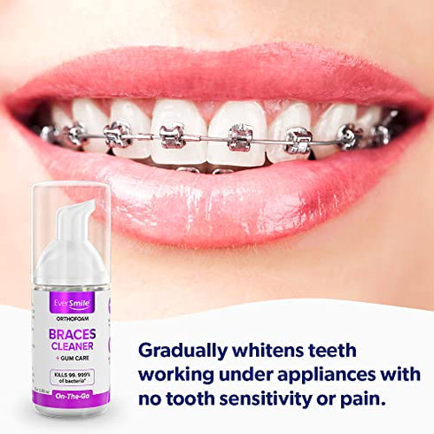 OrthoFoam Braces Cleaner - Cleans Under Metal, Ceramic or Clear Brackets & Wires. Can Brush or Rinse With & Use in Trays. Foaming Bubbles Whiten Teeth & Fight Plaque (1 Pack - 25 ml)