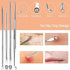 Black Head Remover Pimple Popper Tool Kit 10 Pcs, Comedone Pimple Extractor Tool, Acne Kit for Blackhead, Whitehead Popping, Zit Removing(Silver)