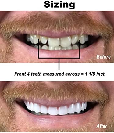 Instant Smile Comfort Fit Flex - Bright White - Upper Veneer Cosmetic Teeth