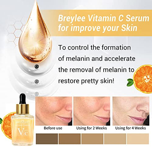 BREYLEE Vitamin C Serum for Face & Eye (1.4 oz) for Brightening Skin,Dark Spot Remover,Reduce Wrinkle,Anti Aging Serum,Moisturizer Brightening Serum with Hyaluronic Acid,Vitamin E,Retinol,Nicotinamide
