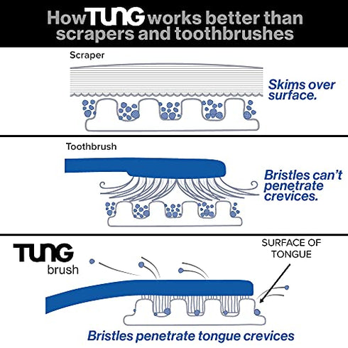 Peak Essentials | Tung Brush & Gel Kit | Tongue Cleaner for Adults | Tongue Scraper to Fight Bad Breath and Halitosis | Mouth Odor Eliminator | Fresh Mint | Made in America (Set of 1)