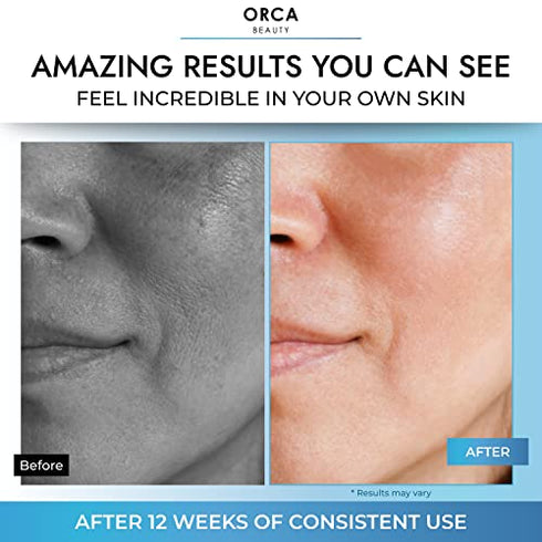 Glycolic Acid Face Serum 2oz - 15% Glycolic Acid Serum AHA Complex with Hyaluronic Acid Serum for Face - Anti Aging Serum with Lactic Acid - Skin Brightening Serum Face Serum for Glowing Skin