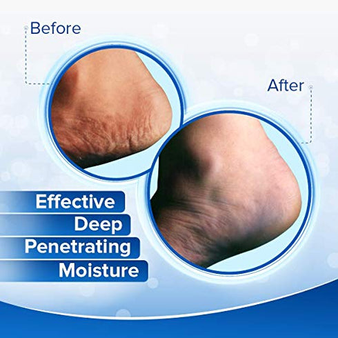 Dermal Therapy Heel Care Cream - Moisturizing Treatment that Repairs and Heals Dry, Rough, Cracked Heels and Feet | 25% Urea and 6% Alpha Hydroxy Acids (3 Ounce) | Packaging May Vary