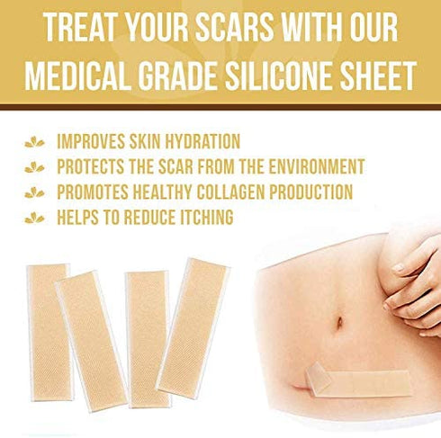 Silicone Scar Removal Sheets, Scar Away Silicone Scars Sheets for C-Section, Acne, Surgery Injuries, Keloid, Burn, Stretch Marks, Works on Recent & Old Scars, 4 Sheets 5.7’’ x 1.57”