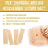 Silicone Scar Removal Sheets, Scar Away Silicone Scars Sheets for C-Section, Acne, Surgery Injuries, Keloid, Burn, Stretch Marks, Works on Recent & Old Scars, 4 Sheets 5.7’’ x 1.57”