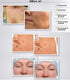 Bepanthen Scar Treatment 20g