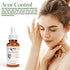 Sonoma Naturals Tea Tree Oil Serum for Face, 1 oz | Acne & Dry Skin | Pore Minimizer | Skin Moisturizing & Healing | Anti Oxidant Rich | Anticeptic & Antifungal