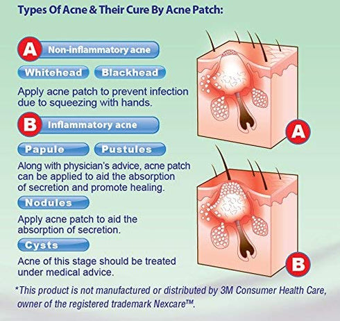 Acne Patch | Absorbing Hydrocolloid Acne Dots | Promotes Clear Skin | Hydro-Band - 1 Pack of 36