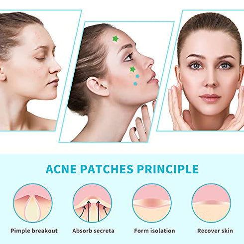 Star-Shaped Pimple Patch Hydrocolloid Acne Stickers with Tea Tree Oil + Salicylic Acid, Cover Dot for Acne Blemish, Pimples, Whiteheads, Zit, Draw out Oil & Impurities, 108 Dots, 12mm & 8mm